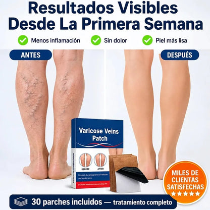 Parches Para Varices - Alivio diario de piernas, recupera comodidad y confianza cada día