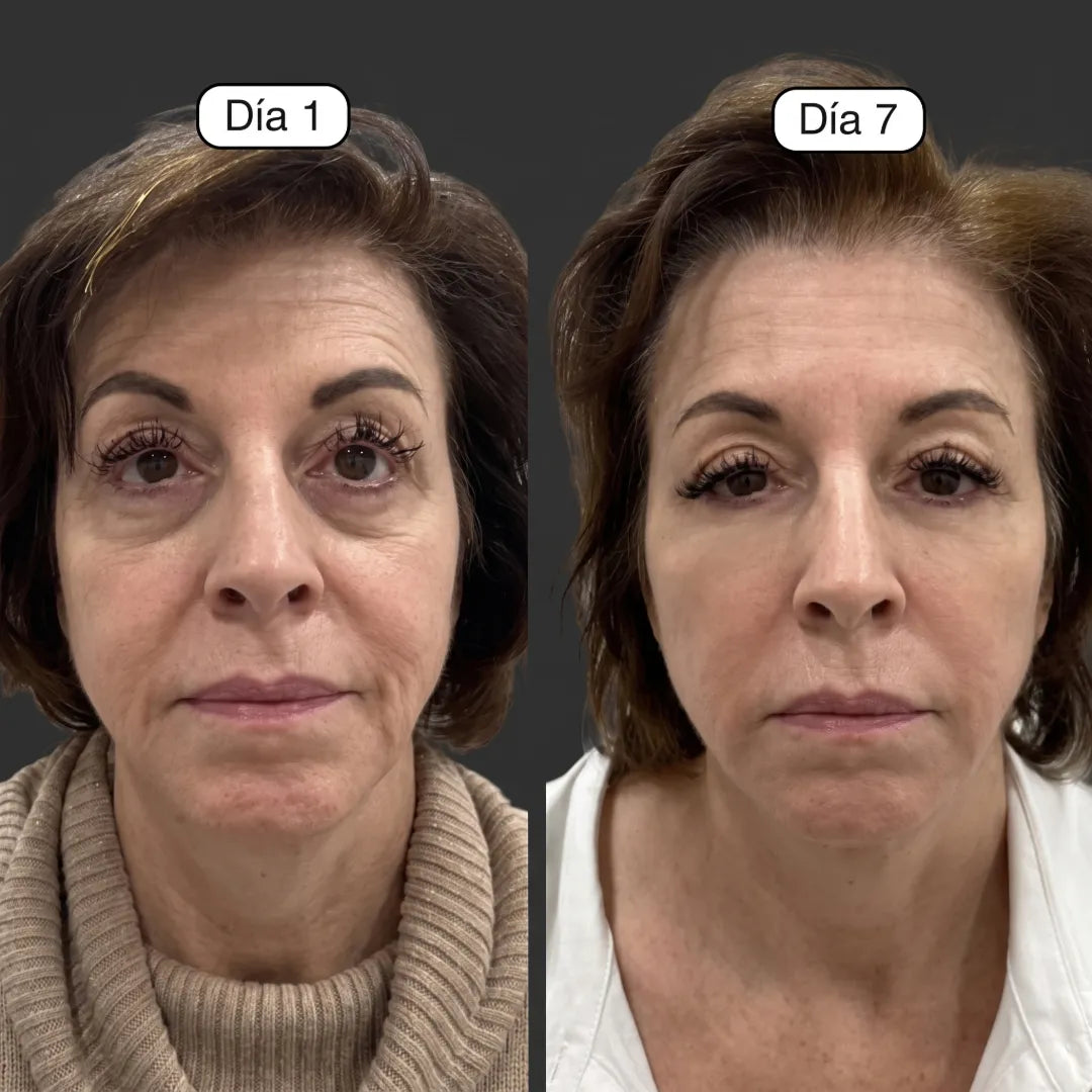 Drenna® Cepillo Facial Para Masajes de Drenaje Linfático