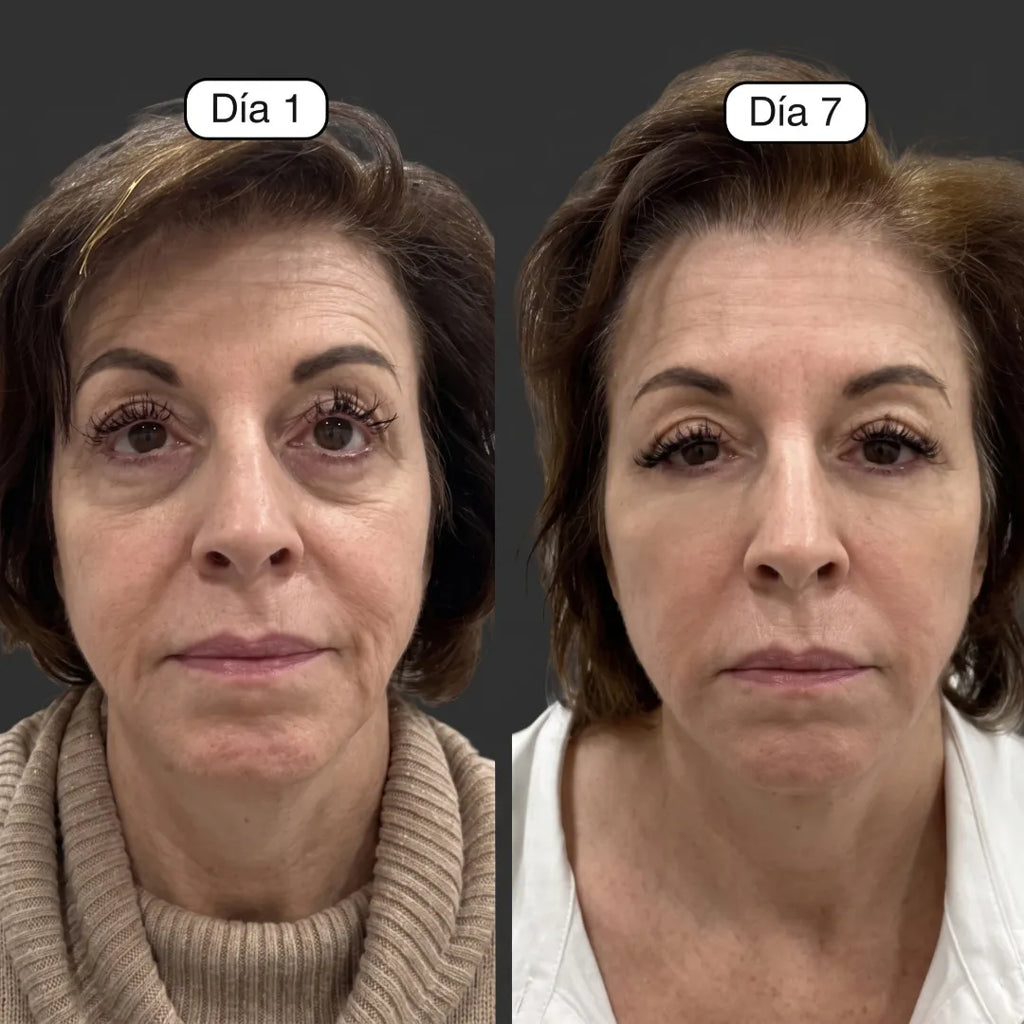 Drenna® Cepillo Facial Para Masajes de Drenaje Linfático