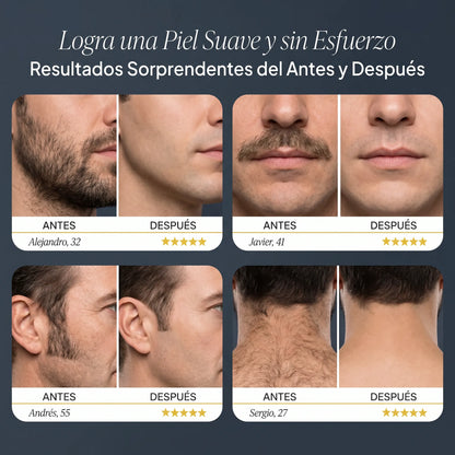 TrimPro® Corte Preciso Para Barba, Bigote, Patillas & Cabello